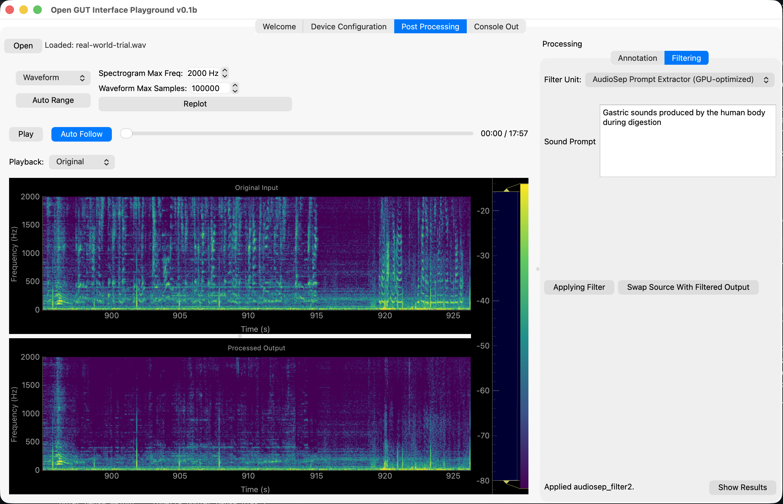 AudioSep-based denoising filter applied to a gastric sound recording.