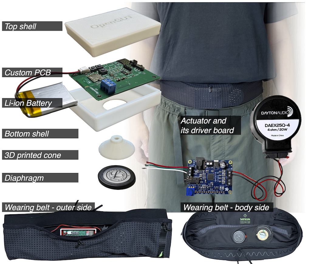 OpenGUT Hardware breakdown image